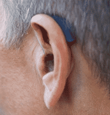 Behind-the-ear (BTE) hearing aids at Westchester Audiology