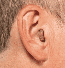 Completely-in-the-canal (CIC) hearing aids